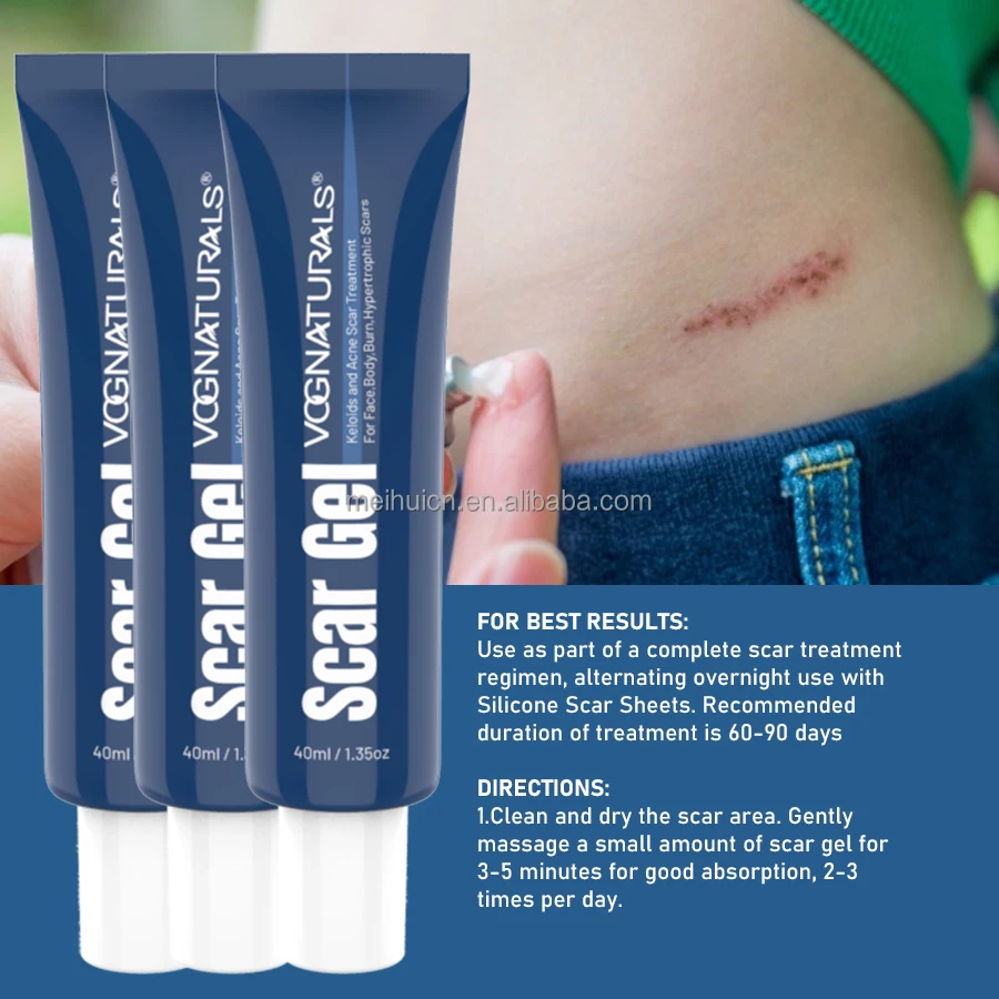 Private Label Deep Acne Scar Removal Cream for Old Scars Stretch Marks