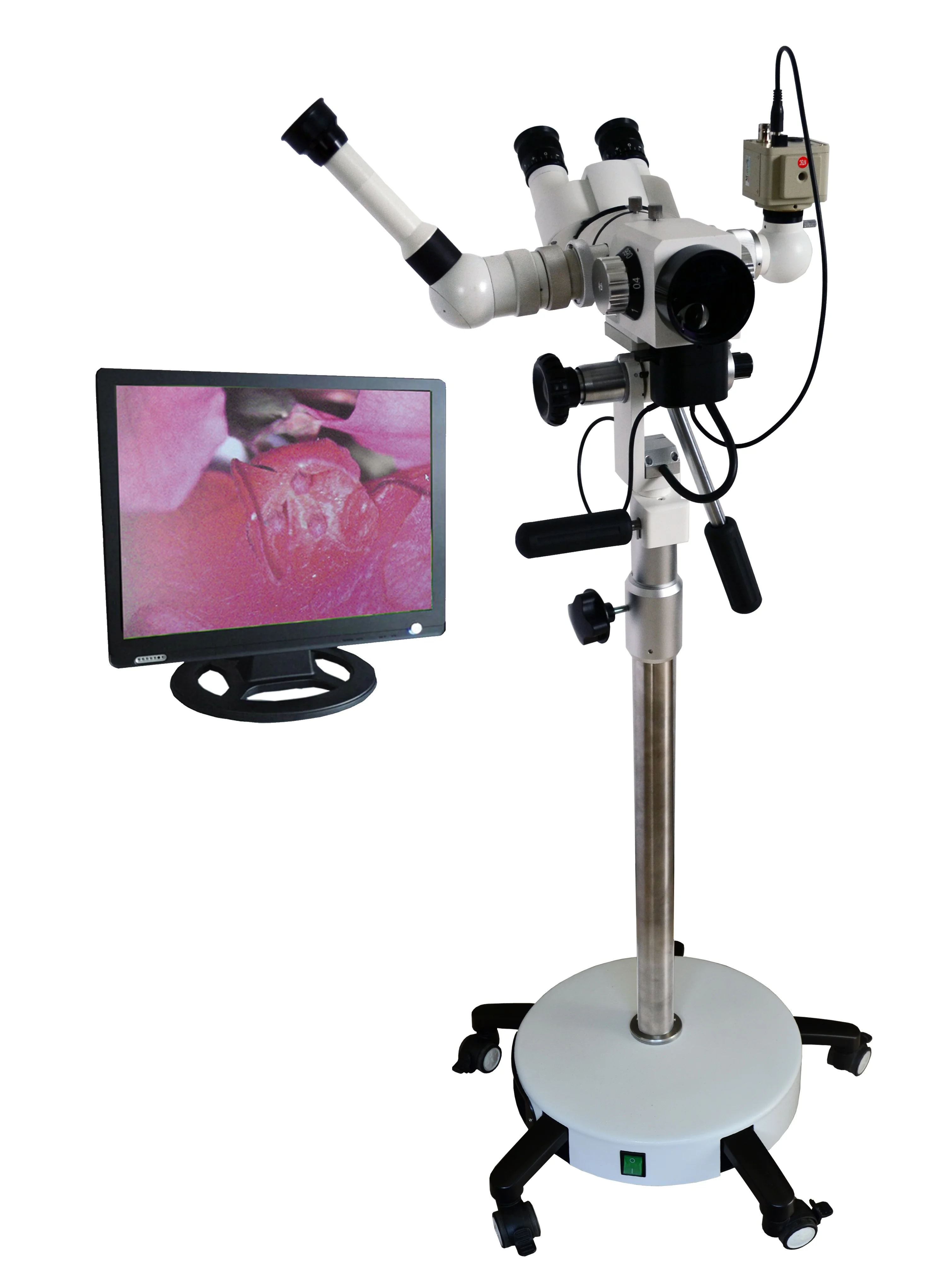 Лучший дешевый цифровой колпоскоп для гинекологии