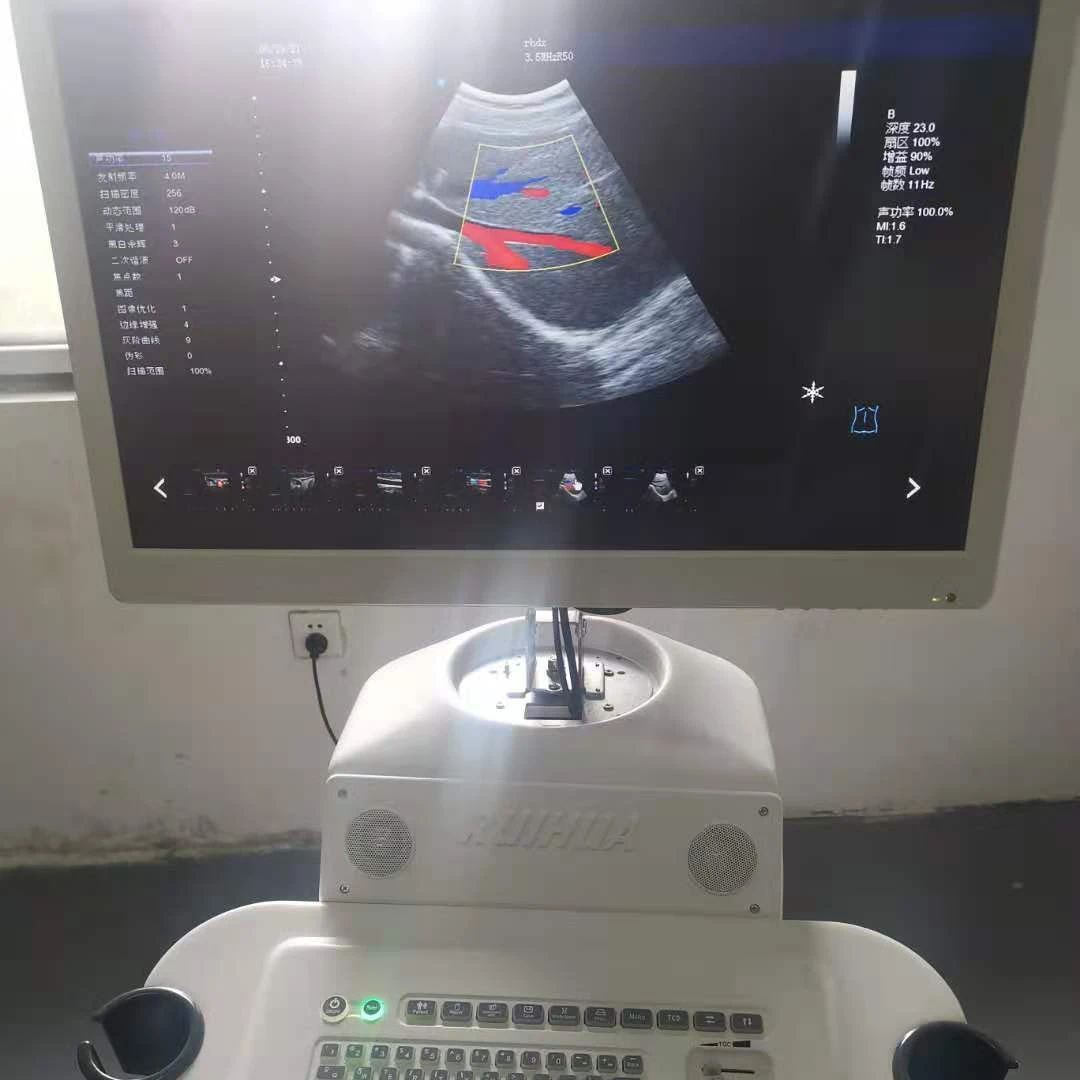 RUIHUA brand manufacturer OB GY and echo 3D  Cheap Color Doppler Ultrasound scanner