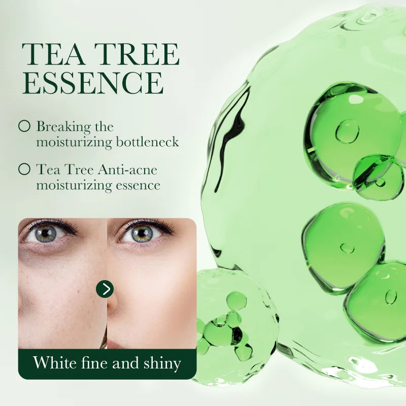 SADOER Oil-control Acne Mark Fade Herbal Natural Tea Tree Cream Anti-acne Smoothing Pimple Repairing Facial Cream