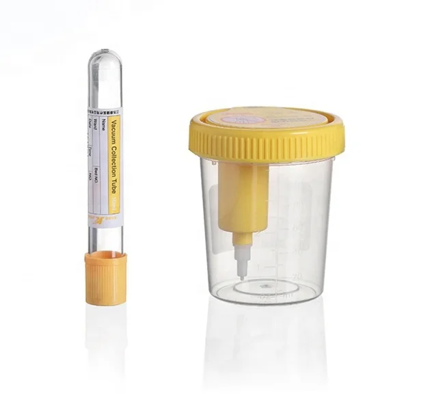 100ml Sterile Urine Container Vacuum Urine Cup