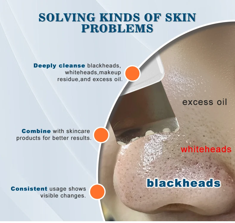 Wholesale Facial Spatula Face Cleaner Deep Cleansing Lifting Acne Blackhead Remover Beauty Device Ultrasonic Skin Scrubber