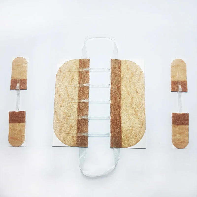 Chinese Factory Direct Wholesale High Pulling Force 1.5 CM Wound Closure Strips  Alternatives For Wound Sutures