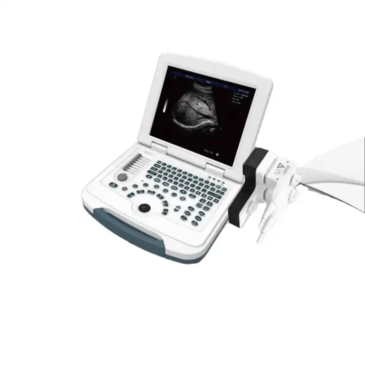 High Quality Thi And Histogram Function Dw-580 Portable Ultrasonic Diagnostic System 12.1 Inch Hd Lcd Display