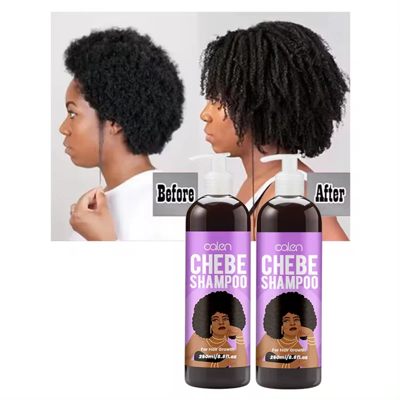 Luxfume custom Logo ремонт поврежденных волос против выпадения перхоти 250 мл шампунь и Кондиционер Chibe