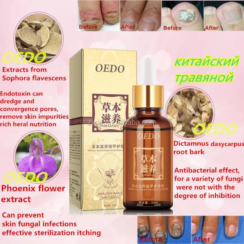 
2020 Wholesale herbal nail repair essence nail treatment for ingrown toa nail anti onychomycosis 