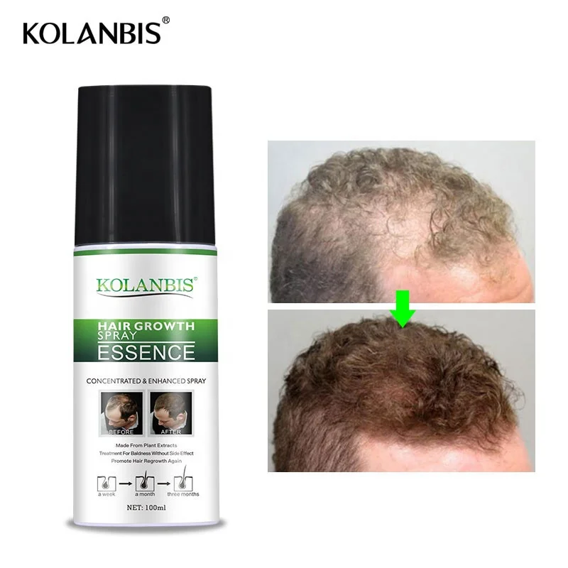  Private Label Hair Oil Growth Serum Men Care Tonic Factory