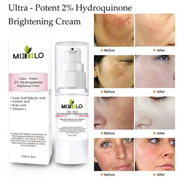 MIMLO Whitening cream Brightening Cream Moisturizing Facial Complexion Lightens Acne Marks Improves Dark Spots 30ml