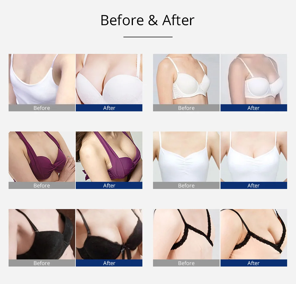 24 Cups Body Massage Vacuum Breast Butt Lifting Beauty Butt Enhancement Machine