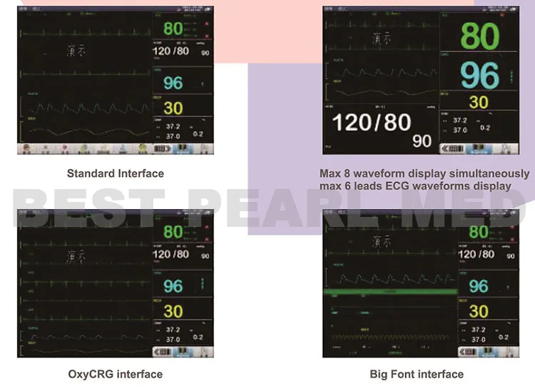 BPM-M1504 Portable Device Wall Mount Veterinary Multi-Parameter Vital Signs Monitor