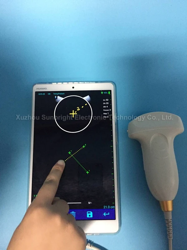 Wifi ultrasound USG wireless ultrasound probe type C connector IOS android mobile device