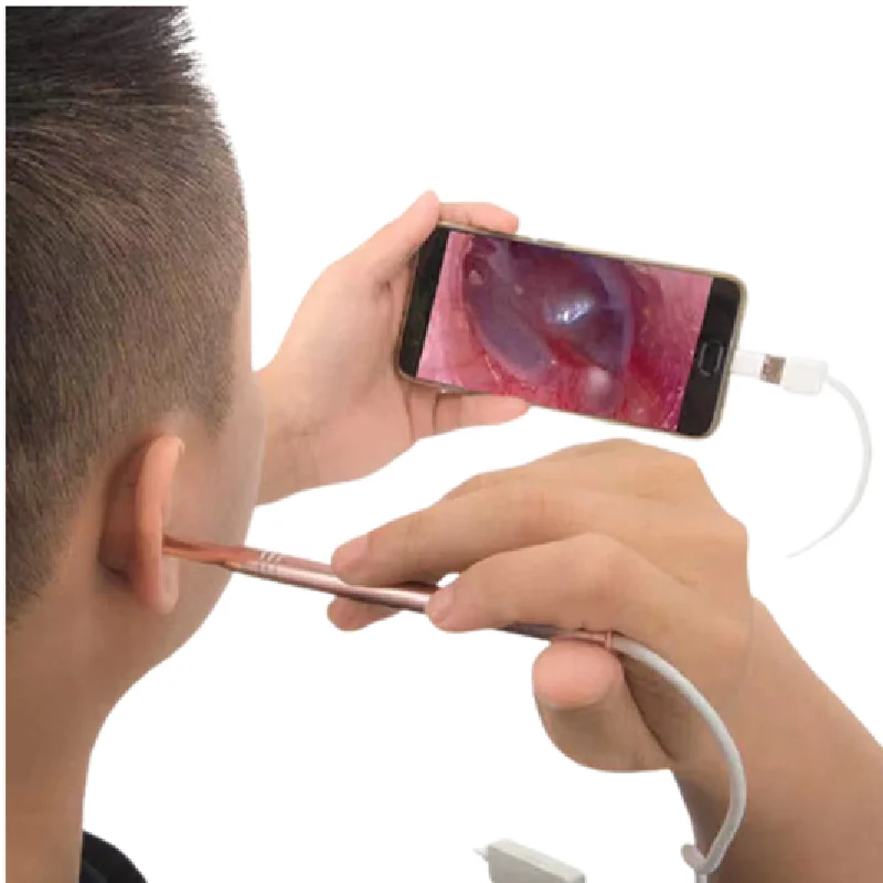 Popular HD Video Digital Otoscope with 3.9 Inch Gift Box Electric Metal Waterproof Silver Ce OEM 1 YEAR 2 in 1 USB Port 6 Pcs