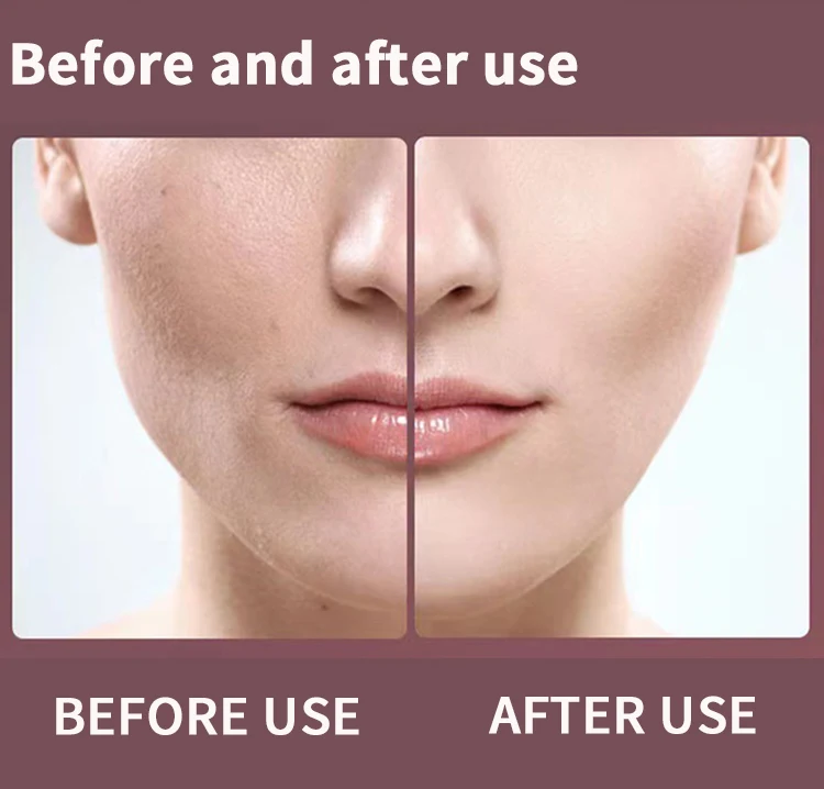 Hot Products EMS Vibration RF V Shape Face Lifting Skin Beauty Tools Device Facial Machine Face Massager Dropshipping Charger