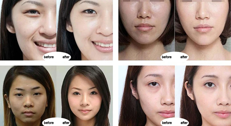 Professional water mesotherapy solution injectable beauty mesogun Vital inject machine from Korea