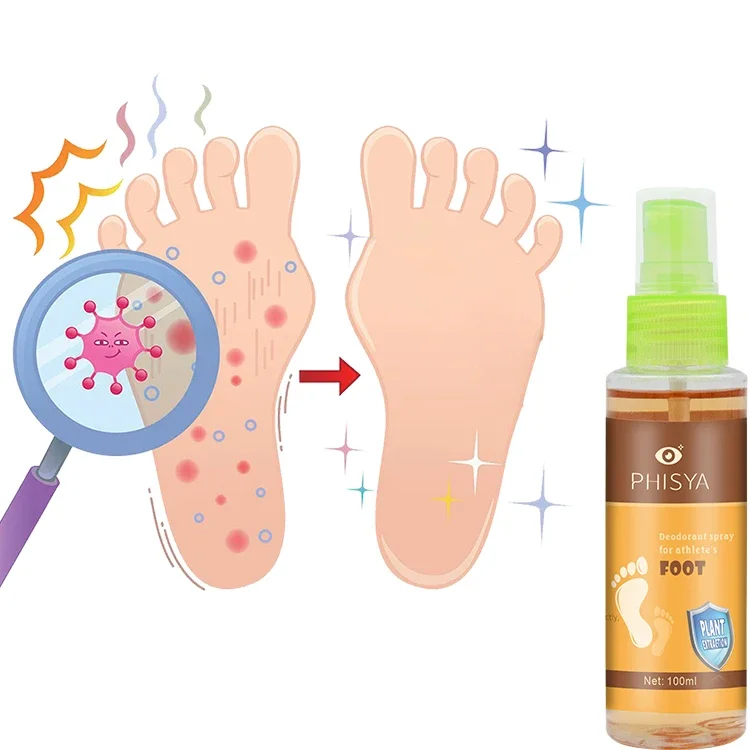 Factory OEM/ODM Great Quality Foot Fungus Odor Beriberi Care Spray Chinese Medicine Herbal Extracts and Essences