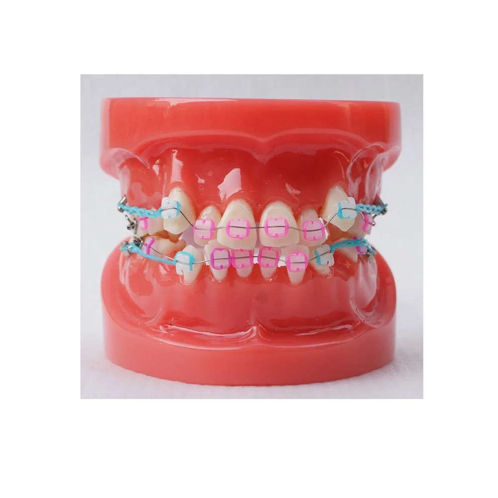Orthodontic study model dental orthodontic teeth jaw model