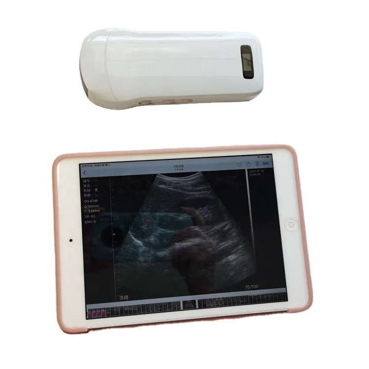 3 in 1 multi-function probe Usb Veterinary Portable Human Medical Machine Handheld  Ultrasound