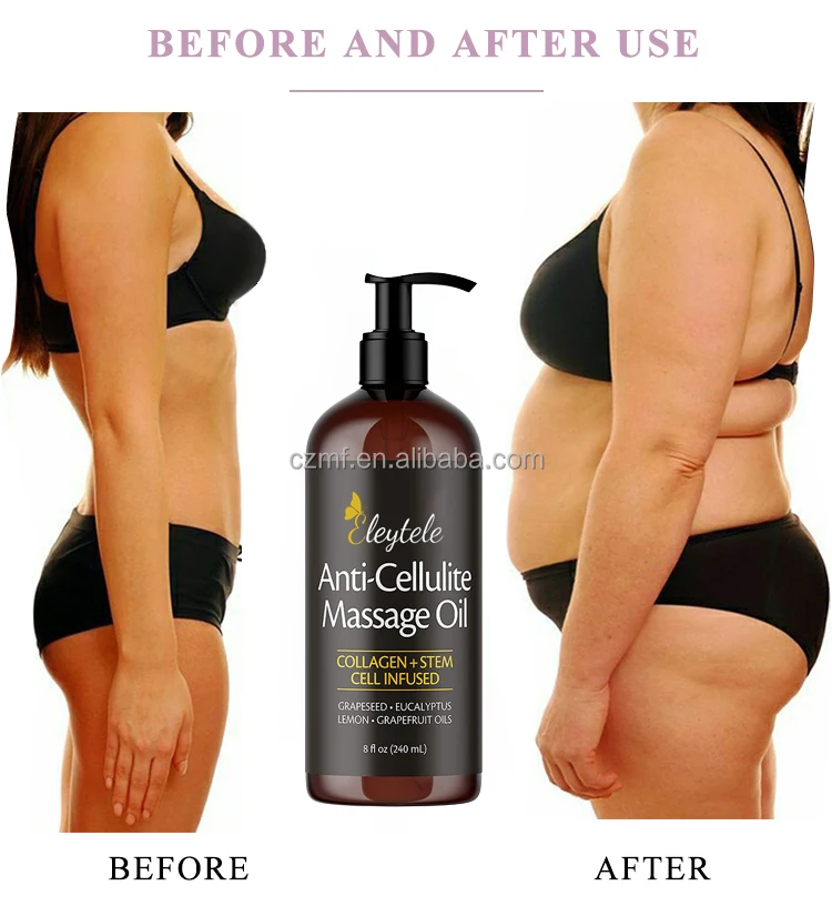 OEM Private Label Natural Organic Herbal Body Care Slimming Oil Fat Burn Hot Massage Anti Cellulite Oil