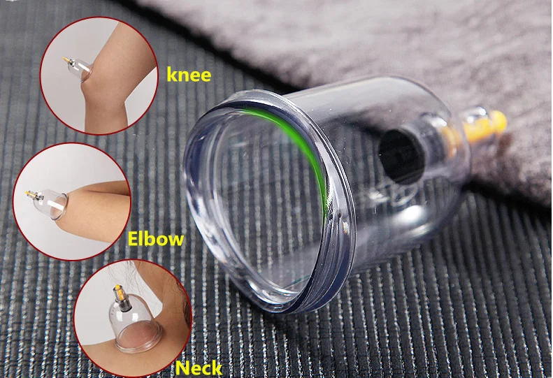high quality  Wholesale set Hijama cups vacuum joint cupping