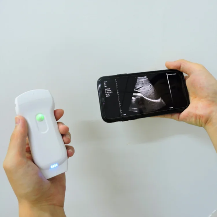  2021 Новый 128 элементы 3 в 1 ультразвуковой Wi-Fi и USB цветной допплер медицинского зонд C10RL от пекина