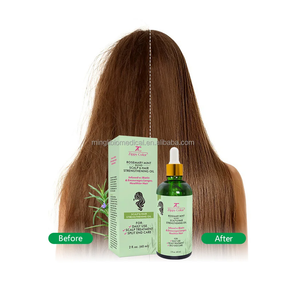 Oem & Odm China Hair Oil Cosmetics Supplier Hair Olive Oil Create Your Own Brand Hair Oil For Home Use