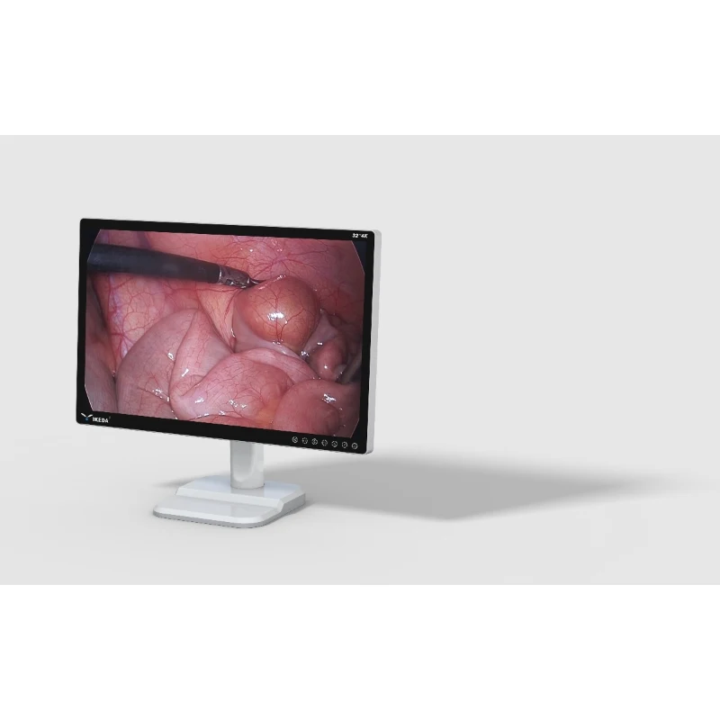 Hot selling AKX 32 inch UHD 3840*2160 4k medical monitor YKD-8132