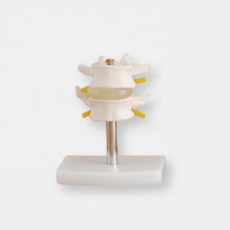 Joint model Medical education Life-Size lumbar vertebral set model human anatomical lumbar retractor set