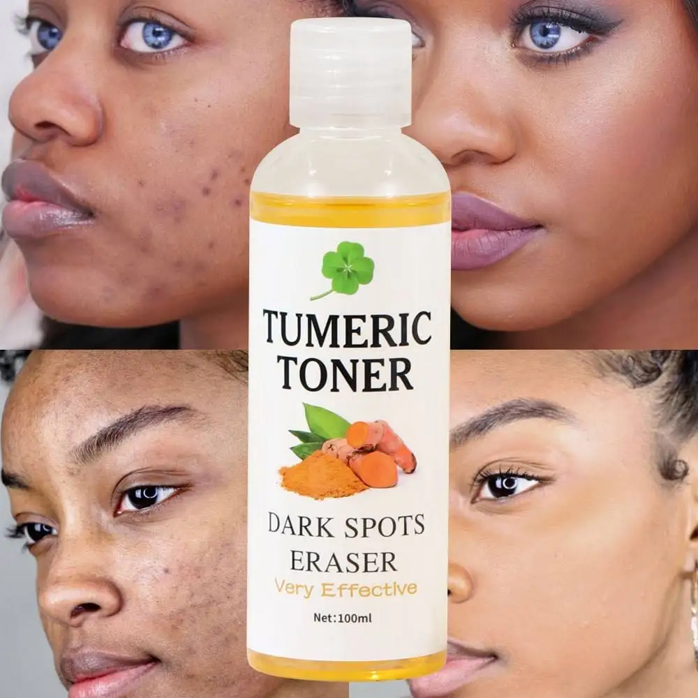 Natural Organic Turmeric Whitening Vitamin C Refershing Moisturizing Mint Facial Skin Care Skincare Moisturizing Face Skin Toner