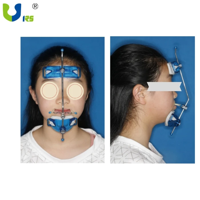 RS Dental Instruments Adjustable Single Pole Face-mask Reverse Pull Headgear Orthodontic Face Bow