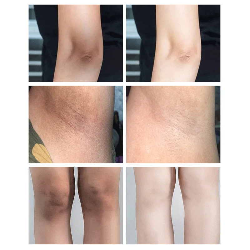 Hot sales Private label OEM skin moisturising lightening body bleaching  dark spot removing skin whitening cream