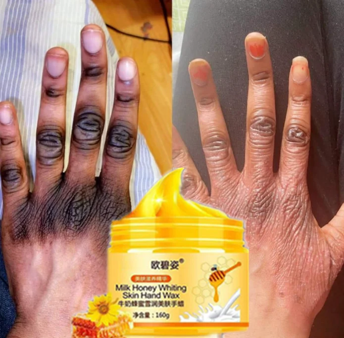 OEM Private Label peeling Body natural Dark knuckles remove yellow peeling oil extra strength body to remove skin layer