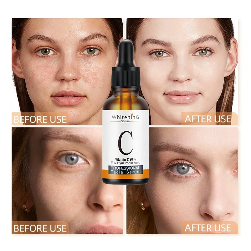 Vitamin C Serum Face Anti Aging Serum Hyaluronic Acid Organic Aloe Vera And Jojoba Oil Hydrating Bright