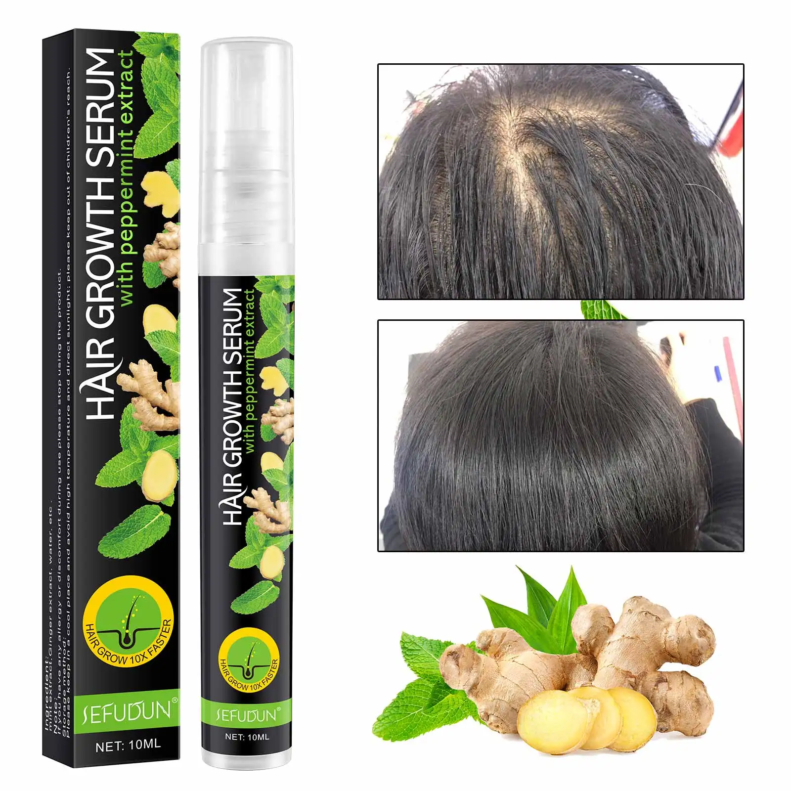 Hair Treatment Serum  Organic Ginger Hair Growth Oil Hot Sale 10ml