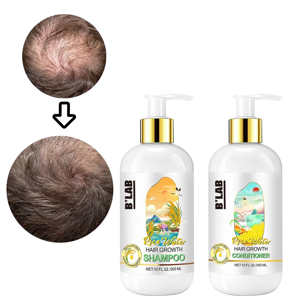 Private Label Natural Hair Loss Treatment Hair Growth Fermented Rice Water Shampoo And Rice Water Conditioner