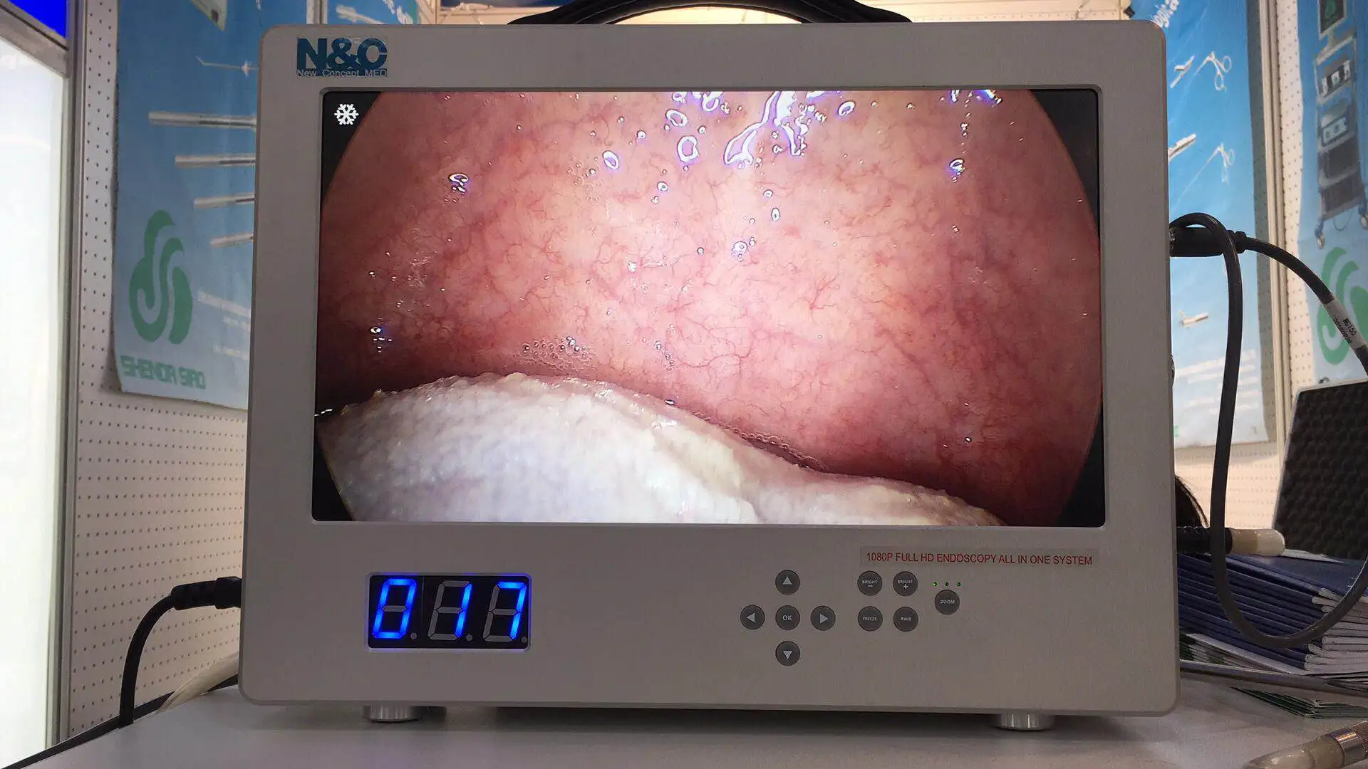 Portable ENT/Laparoscopy/Urology Medical Endoscopy Camera USB Full HD 1080P 4K