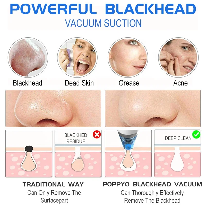 
Personal Skin Care Pore Cleaner Comedo Blackhead Vacuum Remover Kit Extractor For Nose and Face 