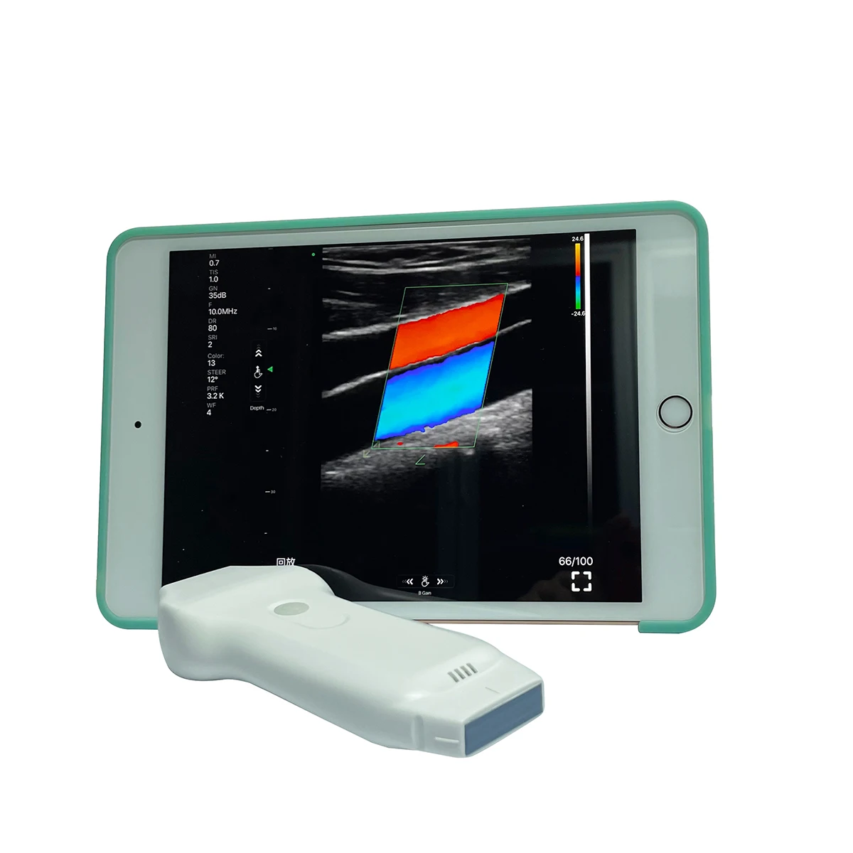 CE Double Probes Wireless Color Doppler Ultrasound Scanner