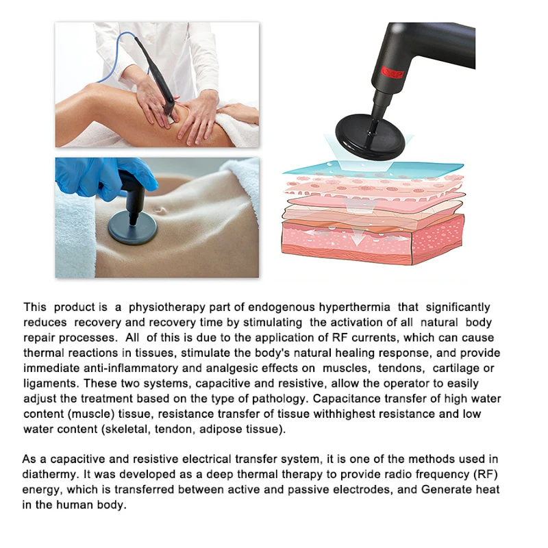 Spanien 448khz Indiba Cet Tecar Therapy Face Lift Pain Relief Body Detox Therapie Physiotherapit Diathermie Machine CET+RET+JMD