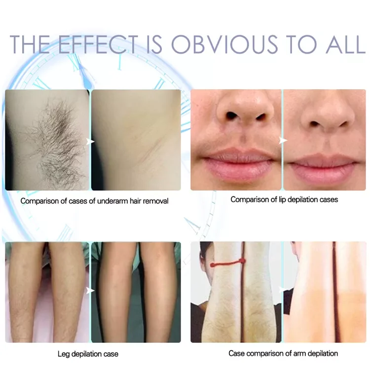 Factory Price High Quality Diode Laser 808 Diode Laser Hair Removal Machine Rejuvenation Beauty Equipment Machine