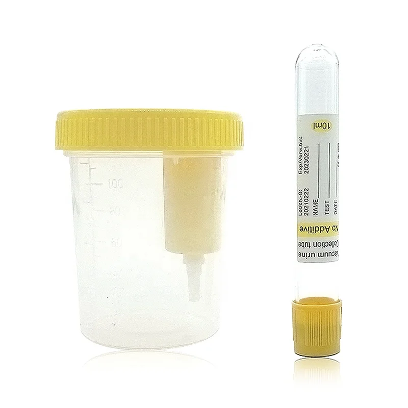 120 мл одноразовый образец вакуумный контейнер для мочи с вакуумной трубкой для сбора мочи стерильные пластиковые чашки