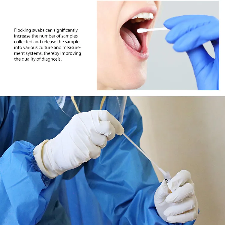 Nasopharyngeal Throat Buccal Sample Collection Test Transport Oral Medical Sampling Foam Swab