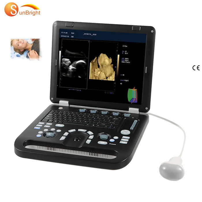 advanced medical 4D laptop CW doppler ultrasound cardiac echo