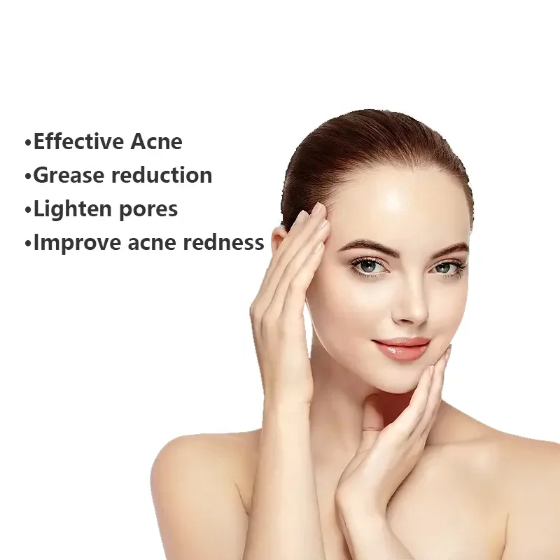 5% Benzoyl Peroxide Hyaluronic Acid Custom Gentle Clean Repair Sensitive Skin Acne Foaming Facial Cleanser Face Wash