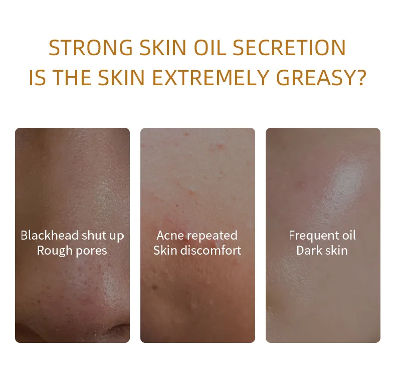 Private Label Portable Fruit Plant Blackhead Remover Clay Mask Deep Cleansing Mud Clay Face Mask