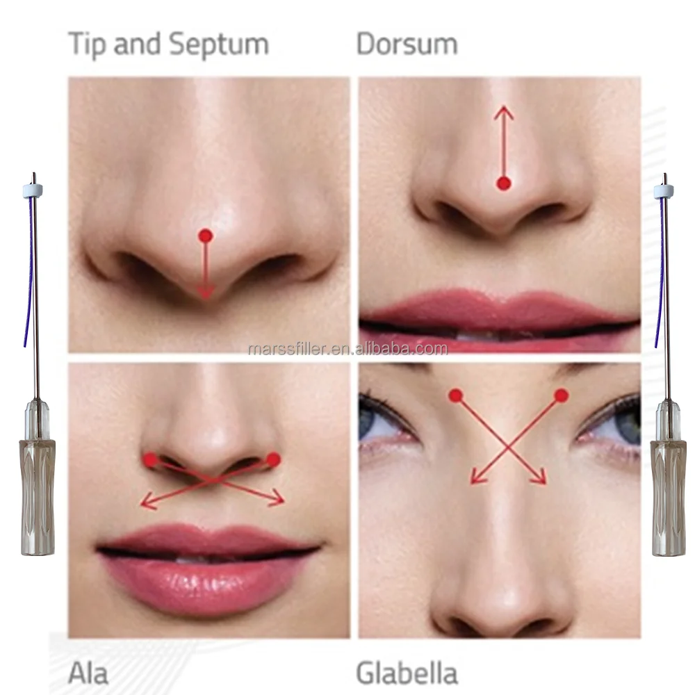 
Hot New products 2021 cog 3D / 4D blunt L needle type pdo threads lift All kinds of models can be customized 