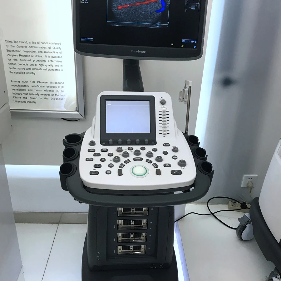 High- Quality S22 SonoScape Ultrasound 3D&4D