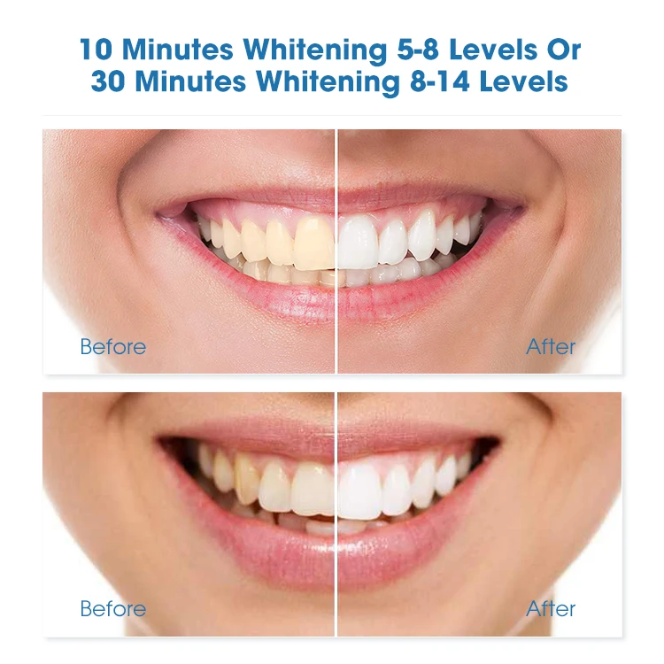  2020 г. LUXSMILE Новый профессиональный комплект для отбеливания зубов в офисе с пероксидом