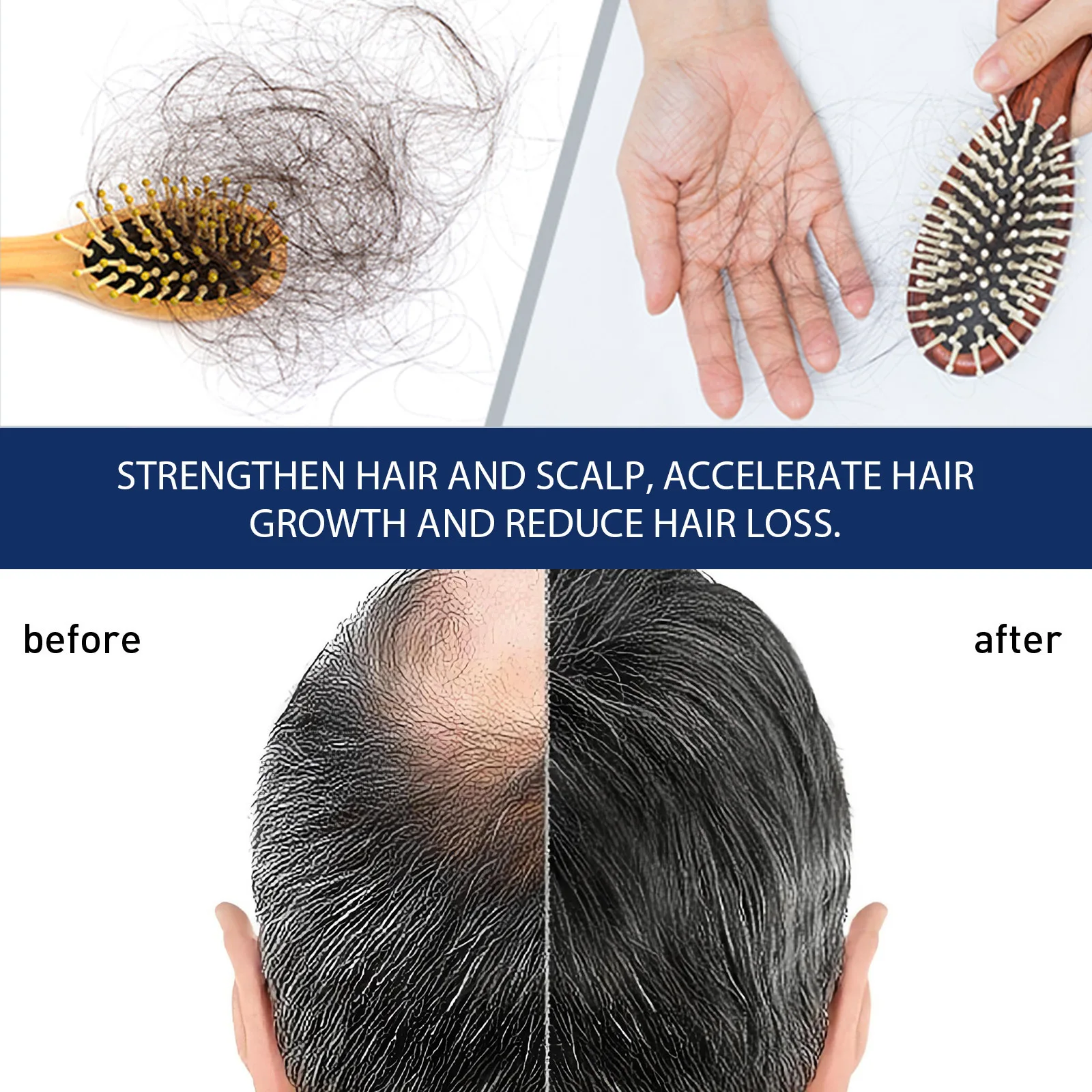 OEM Scalp dense hair care cream Cares for follicles to strengthen hair moisturize thick hairline and strengthen hair