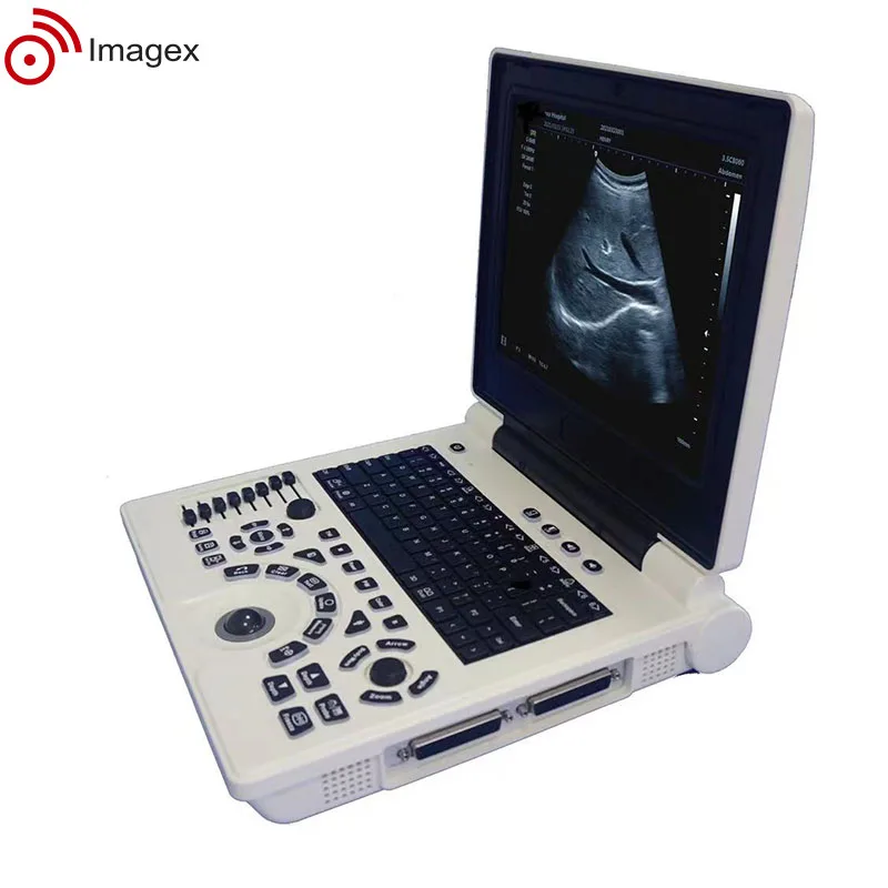 Портативный ультразвуковой аппарат с многочастотными зондами для акушерства и гинекологии