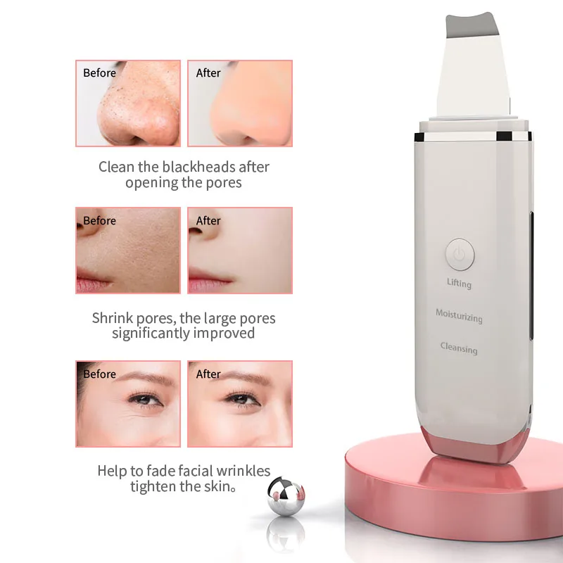 2022 New Product ultrasound EMS skin scrubber facial skin scrubber beauty personal care pore cleaner device